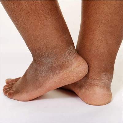 CeraVe Healing Ointment Skin Protectant, Soothes Dry, Cracked And Chafed Skin, Non-Greasy Unscented - 12oz - Image 6